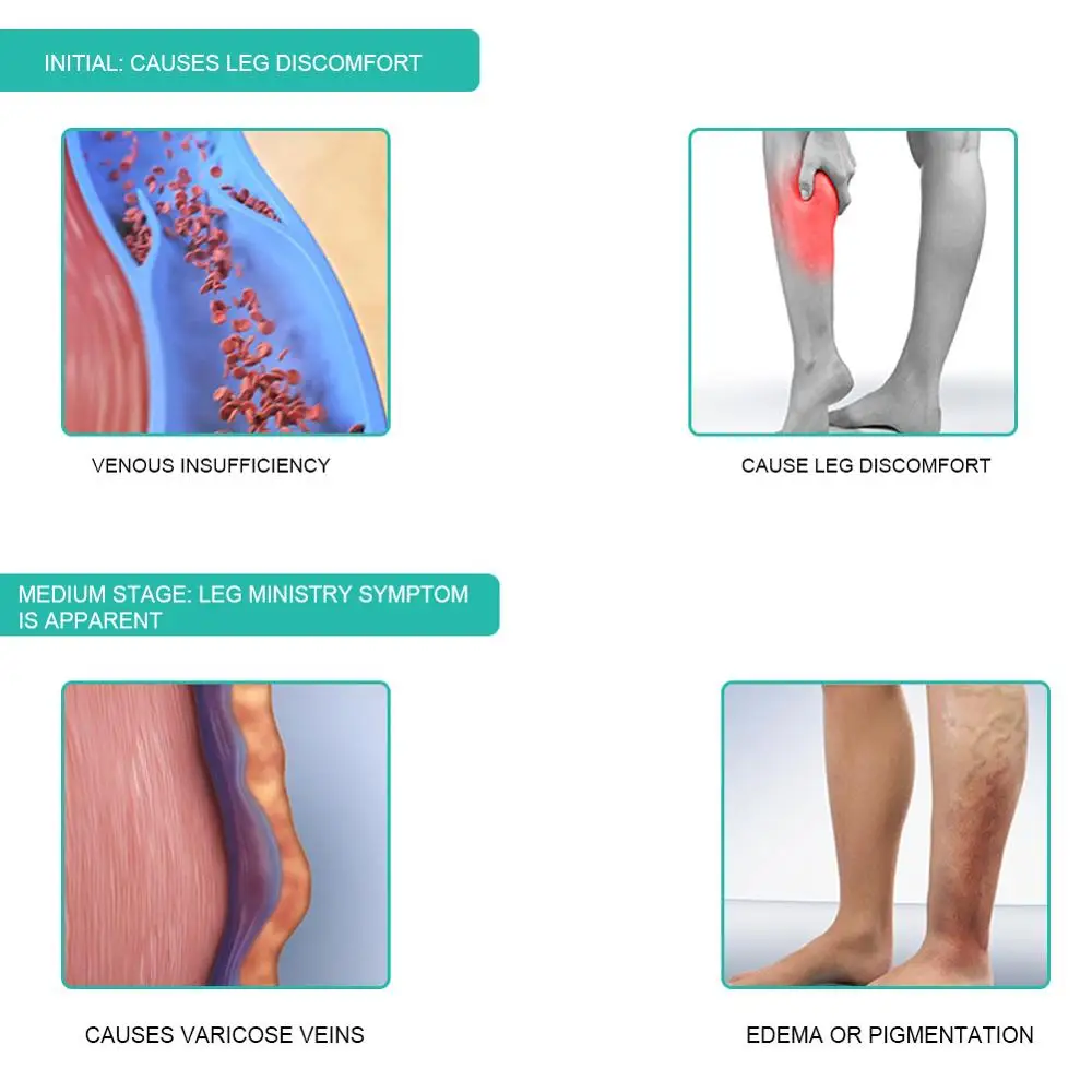 1 쌍 의료 압축 양말 30-40mmHg 중간 튜브 얇 - Compression Sock Medical 리뷰 및 가격