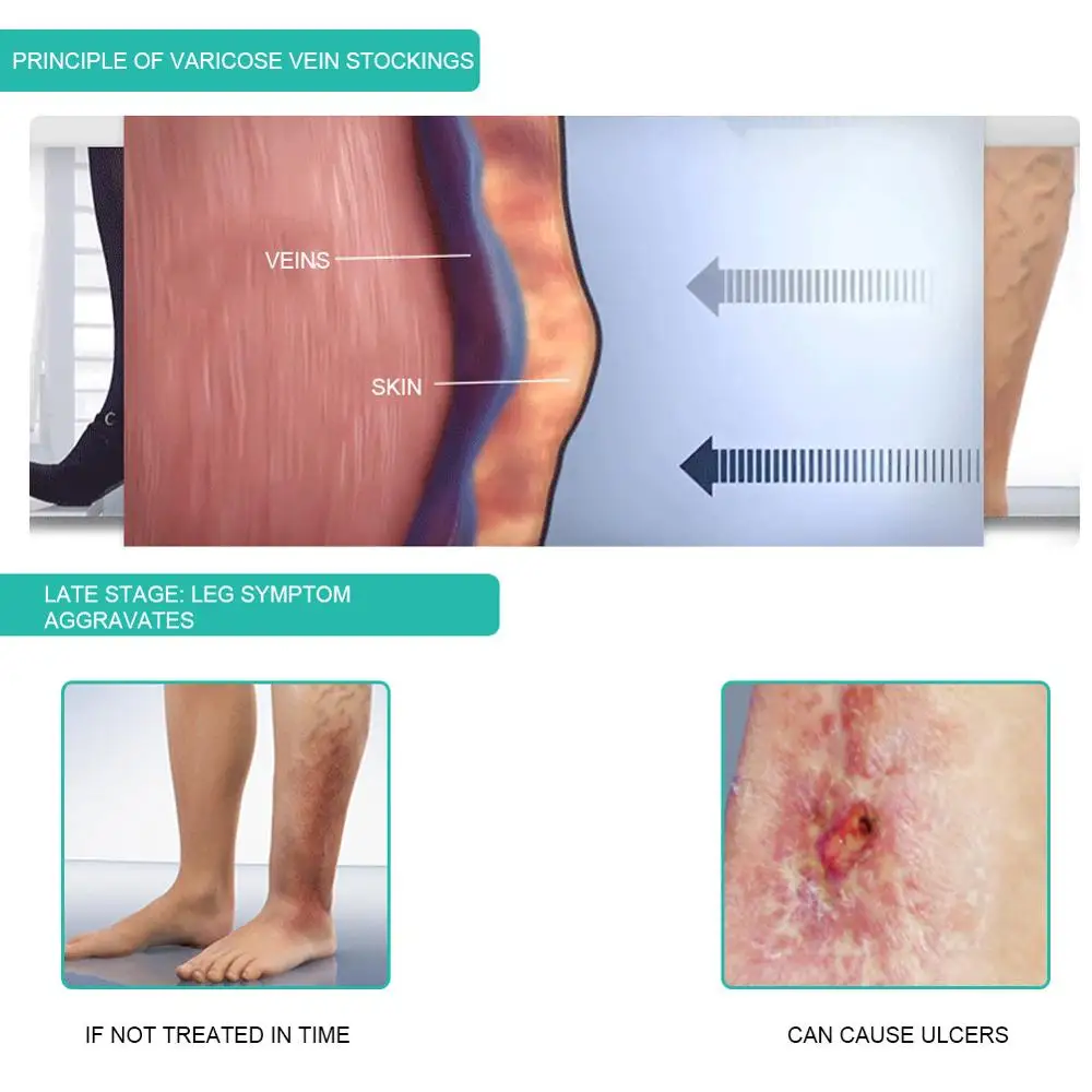 1 쌍 의료 압축 양말 30-40mmHg 중간 튜브 얇 - Compression Sock Medical 리뷰 및 가격
